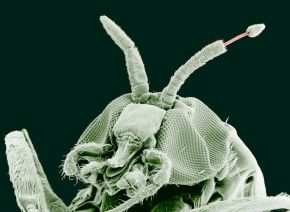 A black fly imaged by an electron microscope is as monstrous as any science-fiction creature.