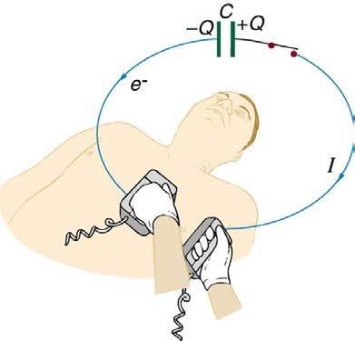 <b>Figure 20.41</b> The capacitor in a defibrillation unit drives a current through the heart of a patient.