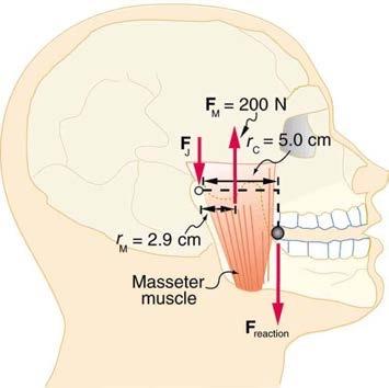 <b>Figure 9.45</b> A person clenching a bullet between his teeth.