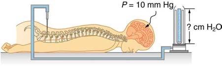 <b>Figure 11.42</b> A water manometer used to measure pressure in the spinal fluid. The height of the fluid in the manometer is measured relative to the spinal column, and the manometer is open to the atmosphere. The measured pressure will be considerably greater if the person sits up.