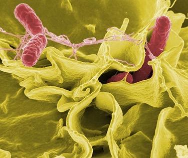 <b>Figure 1.28</b> This color-enhanced photo shows Salmonella typhimurium (red) attacking human cells. These bacteria are commonly known for causing foodborne illness. Can you estimate the number of atoms in each bacterium? (credit: Rocky Mountain Laboratories, NIAID, NIH)